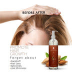 100% Pure & Natural Sweet Almond Oil 16 Oz.™